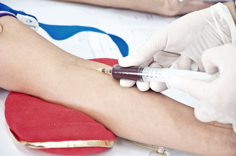 Blood Tests for Allergies Allergies and Health