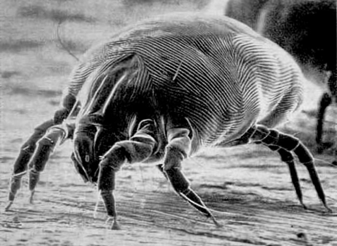 10 Tips To Get Rid Of House Dust Mites Allergies And Health